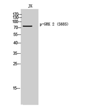 GRK 2 (phospho Ser685) rabbit pAb Antibody