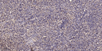 CYP17A1 rabbit pAb Antibody