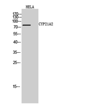 CYP21A2 rabbit pAb Antibody