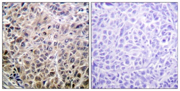 DAPK1 rabbit pAb Antibody