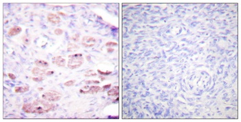 Daxx (phospho Ser668) rabbit pAb Antibody