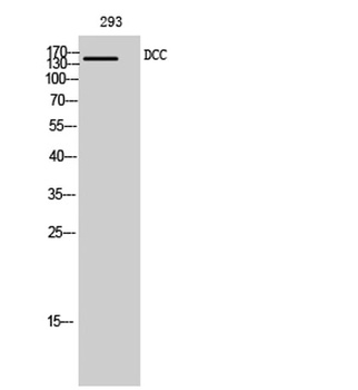 DCC rabbit pAb Antibody