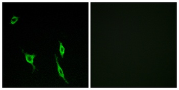 DCC rabbit pAb Antibody