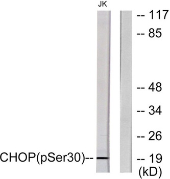 CHOP (phospho Ser30) rabbit pAb Antibody