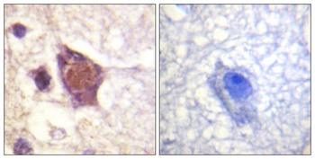 DDX3 (phospho Thr322) rabbit pAb Antibody
