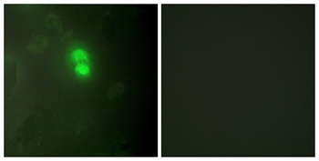 Dyskerin rabbit pAb Antibody