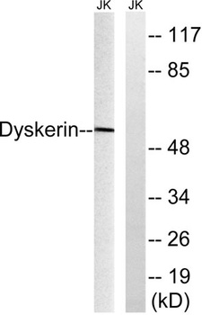 Dyskerin rabbit pAb Antibody