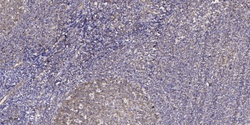 Dyskerin rabbit pAb Antibody