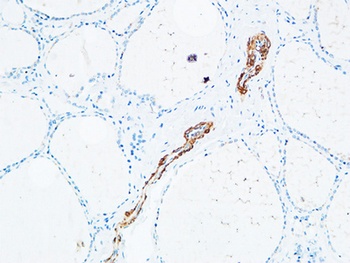 TdT rabbit pAb Antibody