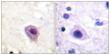 CRMP-2 (phospho Thr514) rabbit pAb Antibody