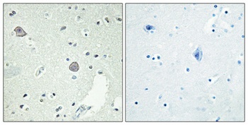 D1DR rabbit pAb Antibody