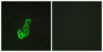 D1DR rabbit pAb Antibody