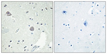 D1DR rabbit pAb Antibody