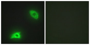 MKP-3 rabbit pAb Antibody
