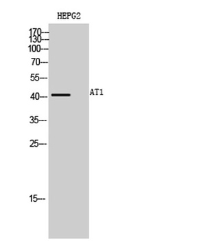 AT1 rabbit pAb Antibody