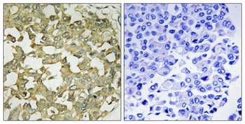 APLNR rabbit pAb Antibody