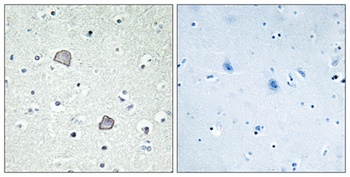 EDG-2 rabbit pAb Antibody