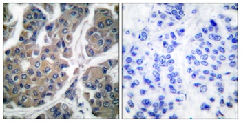 EF-2 (phospho Thr56) rabbit pAb Antibody