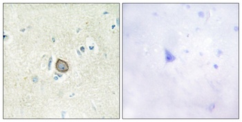 CDHF11 rabbit pAb Antibody