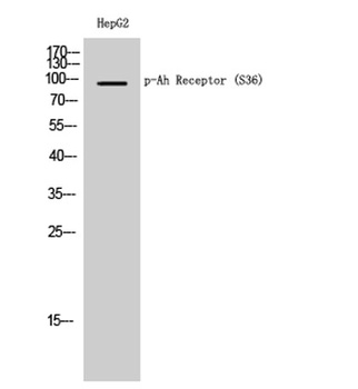 Ah Receptor (phospho Ser36) rabbit pAb Antibody