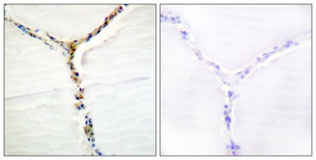 Ah Receptor (phospho Ser36) rabbit pAb Antibody