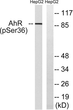 Ah Receptor (phospho Ser36) rabbit pAb Antibody