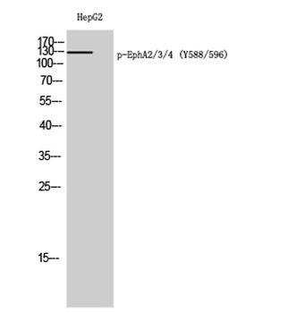 EphA2/3/4 (phospho Tyr588/596) rabbit pAb Antibody