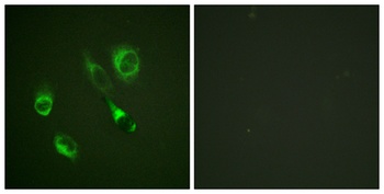 EphA2/3/4 (phospho Tyr588/596) rabbit pAb Antibody