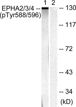 EphA2/3/4 (phospho Tyr588/596) rabbit pAb Antibody