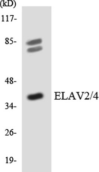 HuB/D rabbit pAb Antibody