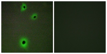 IGSF4C rabbit pAb Antibody