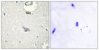 IGSF4C rabbit pAb Antibody