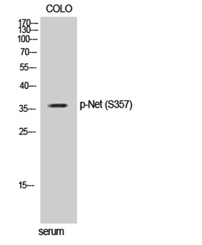 Net (phospho Ser357) rabbit pAb Antibody