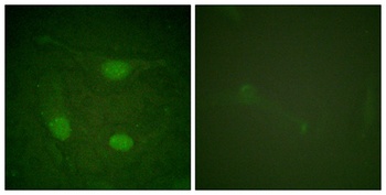 Net (phospho Ser357) rabbit pAb Antibody