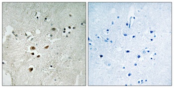 Net (phospho Ser357) rabbit pAb Antibody