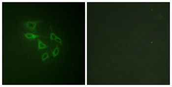 PIP5KIII (phospho Ser307) rabbit pAb Antibody