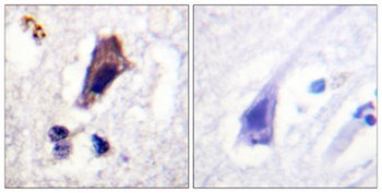 PIP5KIII (phospho Ser307) rabbit pAb Antibody