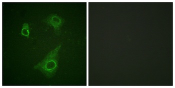 EpoR (phospho Tyr368) rabbit pAb Antibody