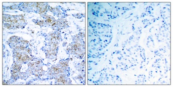 Neu rabbit pAb Antibody