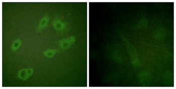 ErbB-3 (phospho Tyr1222) rabbit pAb Antibody