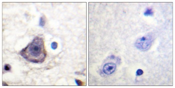 ErbB-3 (phospho Tyr1222) rabbit pAb Antibody