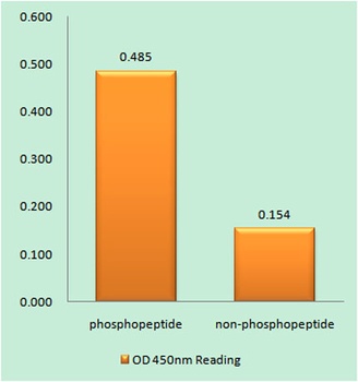 ERα (phospho Tyr537) rabbit pAb Antibody