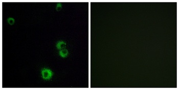 PAR-3 rabbit pAb Antibody