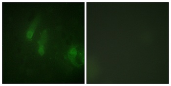 FANCA (phospho Ser1149) rabbit pAb Antibody