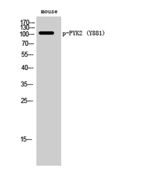 PYK2 (phospho Tyr881) rabbit pAb Antibody