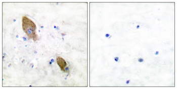PYK2 (phospho Tyr881) rabbit pAb Antibody