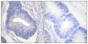 PYK2 (phospho Tyr580) rabbit pAb Antibody