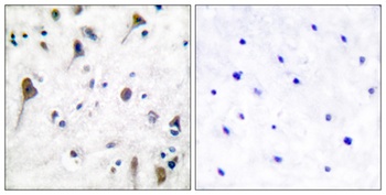 PYK2 (phospho Tyr580) rabbit pAb Antibody