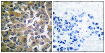 Seprase rabbit pAb Antibody