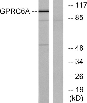 GPRC6A rabbit pAb Antibody